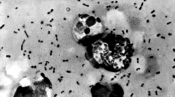 Bubonic plague bacteria taken from a patient in 2003. (Center for Disease Control / AFP / Getty Images)